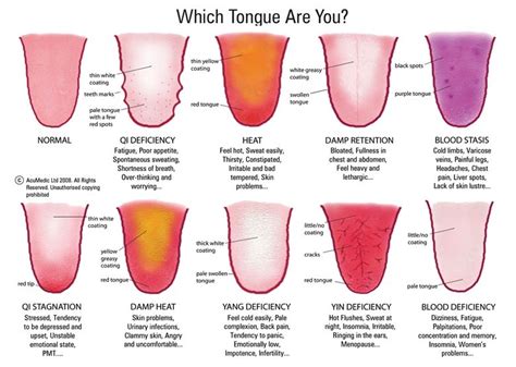 What Is Tongue Diagnosis And How Does It Work By Transformational