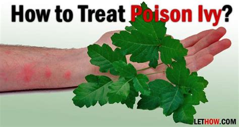 How To Get Rid Of Poison Ivy Rashes Fast With Images Poison Oak