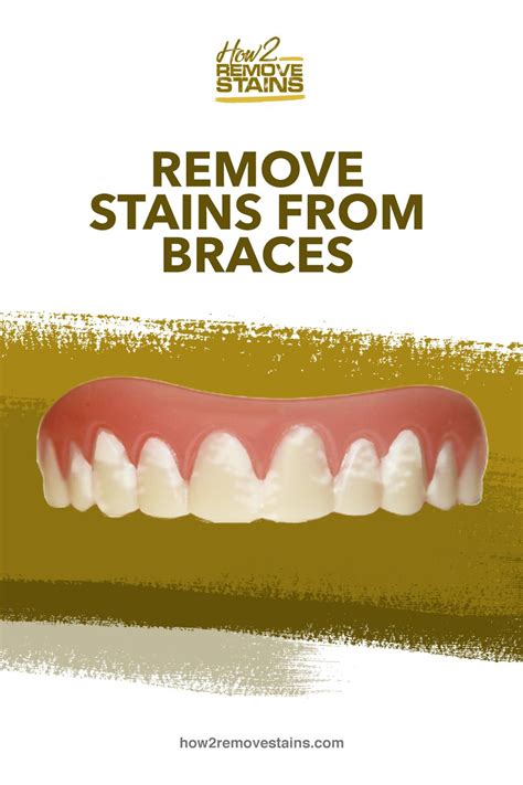 How To Remove Stains From Braces How To Remove Stain Teeth Stain