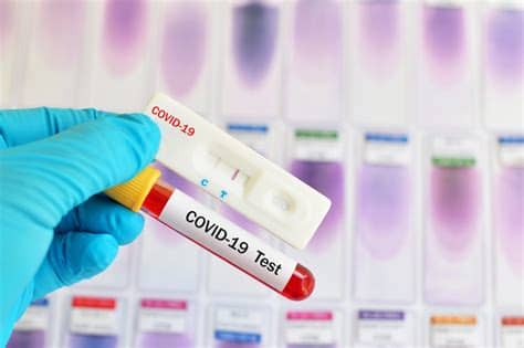 For use under an emergency use authorization (eua) only for use with nasal swab specimens for in vitro use only rx only. COVID-19 Antibodies Rapid Test and RT-PCR(*) Test | Keralty