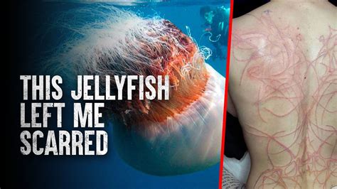 How To Survive The 10 Most Dangerous Jellyfish In The World Youtube