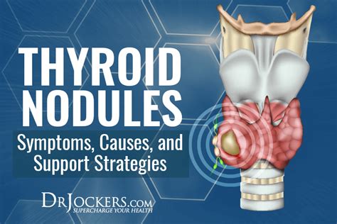 Thyroid Health Archives