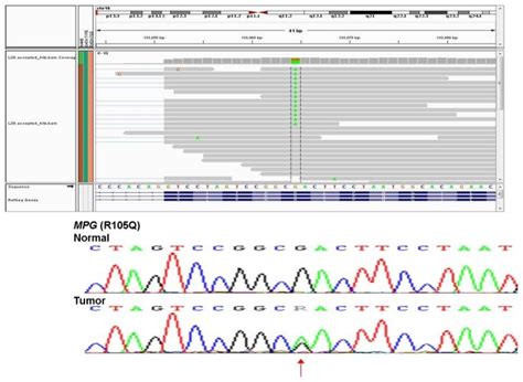 Sanger Sequencing Validation Of Mpg Esnv In Her2 Tumor Rna Seq Reads Download Scientific