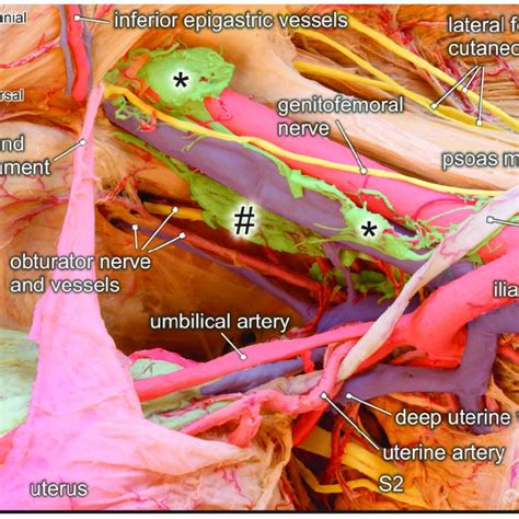 Topographic Anatomy Of The Posterior Pelvic Compartment Dorsocranial
