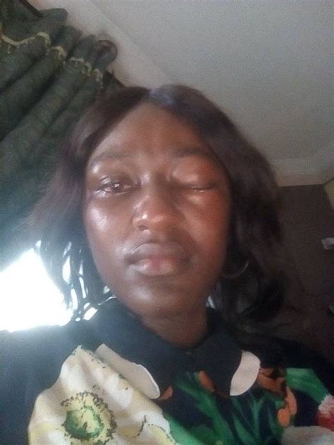 I Shall Not Die Before My Time Nigerian Woman Cries Out After Husband Allegedly Battered Her
