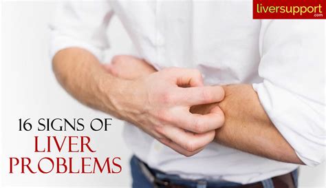 16 Signs Of Liver Damage