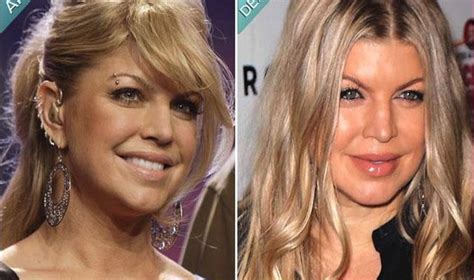 Fergie Before And After Plastic Surgery Including Nose Job And Boob Job