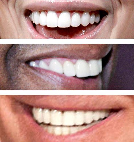 Teeth Are Becoming Less Perfect The New York Times