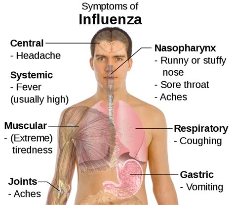 Severe Influenza Virus Hits Australia The Healthy Bear