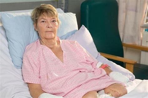 Sepsis Survivor Who Lost All Four Limbs Thanks Milton Keynes Hospital For Saving Her Life