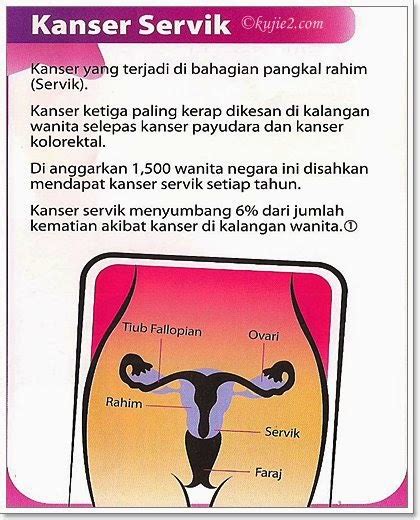 Ini bermakna lebih 1,300 wanita didiagnosis menghidapi kanser serviks dan lebih 750 wanita mati akibat penyakit ini. Kanser Serviks | ~ Duta Langsing dan Cantik