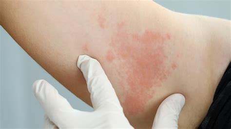 The Common Skin Diseases That Require Medical Attention Impulse Today