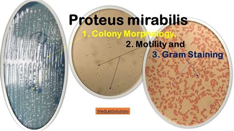 Proteus Mirabilis Colony Morphology Motility And Gram Staining Youtube