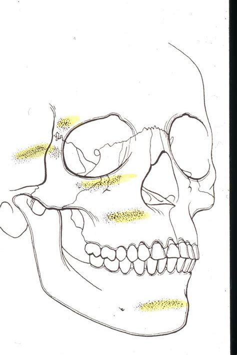 Traumatologia e deformità post traumatiche. - Dr. Luigi ...