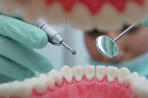 Top Trends In Cosmetic Dentistry Miosuperhealth