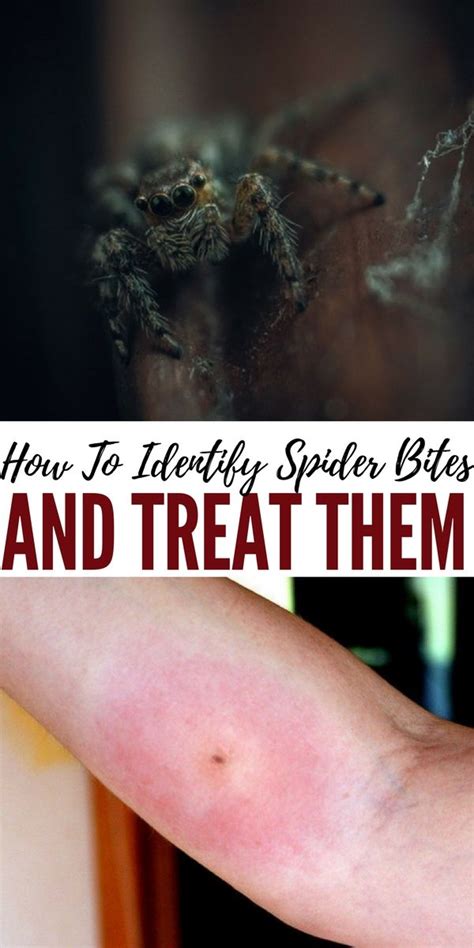 Identify The Deadly Spiders Of North America Shtfpreparedness