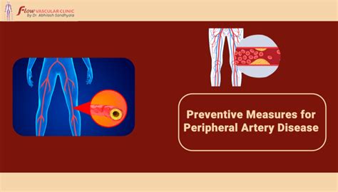 Preventive Measures For Peripheral Artery Disease Dr Abhilash