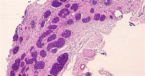 Digital And Computational Pathology Crosscope