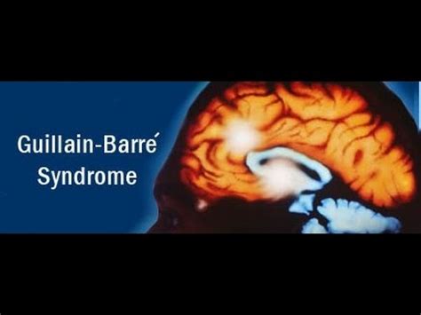 Gbs can cause symptoms that last for as little as a few weeks or go on for several months. Guillain-Barré syndrome - YouTube