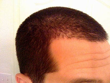 Josh brolin short straight dark grey hairstyle. NCHTJC | 1/4 inch buzz cut right