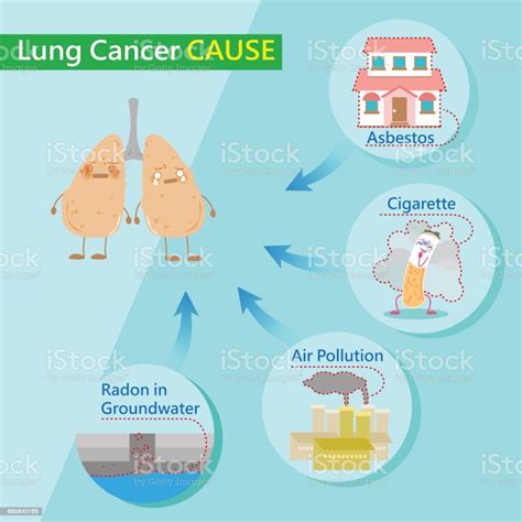 Lung Cancer Causes Stock Illustration - Download Image Now - iStock
