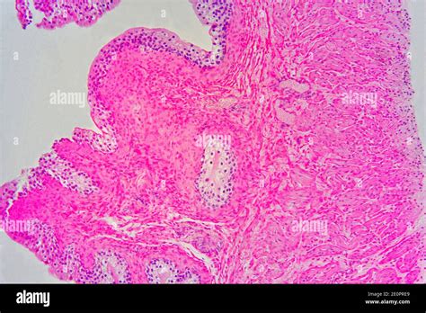 Urinary Bladder With Urothelium Transitional Epithelium Connective