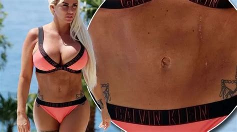 Katie Price S Painful Surgery Scars Clear For All To See As She Strips Down To Bikini Mirror