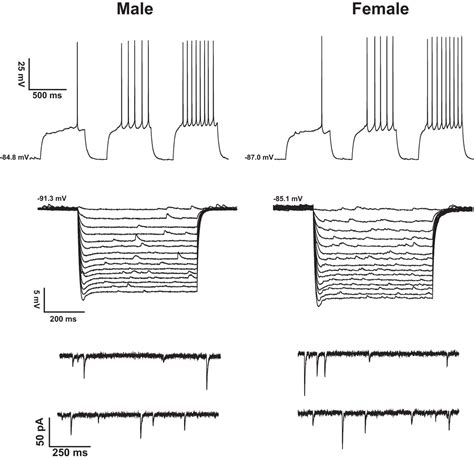 No Evidence For Sex Differences In The Electrophysiological Properties