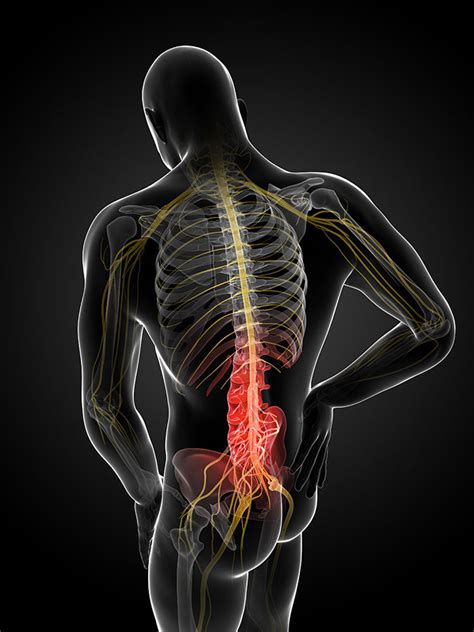 Nerve Diagram Lower Back Pain