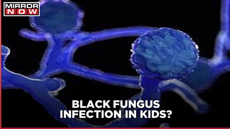 Experts Alarmed As 2 Children Contract Black Fungus In Karnataka