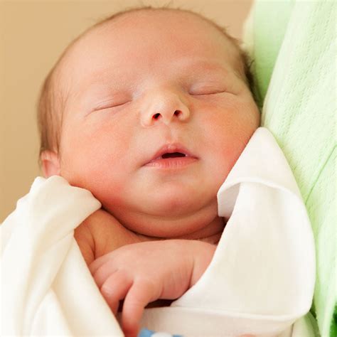 Urgent Care Center What Causes Jaundice In Newborn Babies