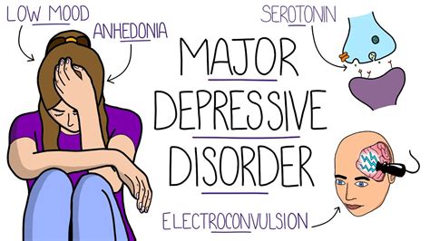 Depression Explained Major Depressive Disorder Youtube