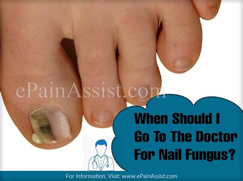 But as a parent, what you should do about a fever depends largely on your child's age and the temperature reading. When Should I Go To The Doctor For Nail Fungus?