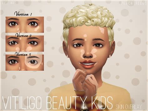 Sims 4 Vitiligo Skin Detail Lifestylehor