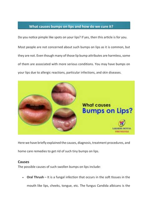 Ppt What Causes Bumps On Lips And How Do We Cure It Powerpoint