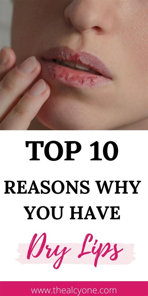 Reasons Why Your Lips Are Dry And How To Fix It The Alcyone Very