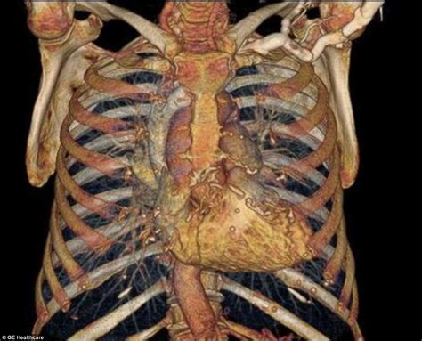 Your rib cage protects your heart and stomach,because the rib cage is kind of a cage and when you get hit there,it dosent hurt your organs but it can damage the rib cage. The Eisenhower Dime && Human Anatomy : MandelaEffect