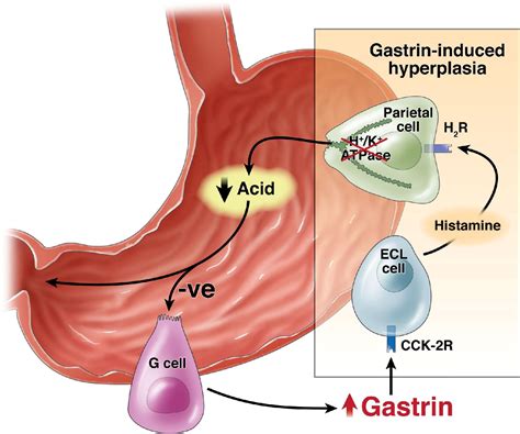 Gastrin In Gastrointestinal Diseases Gastroenterology