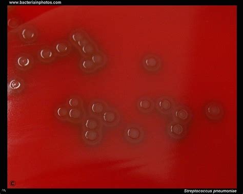Streptococcus Pneumoniae Colonies Medical Technology Medical