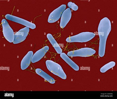 Coloured Scanning Electron Micrograph Sem Of Clostridium Botulinum