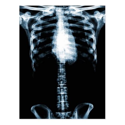 X Ray Skeleton Torso Ribs Blue Postcard Zazzle