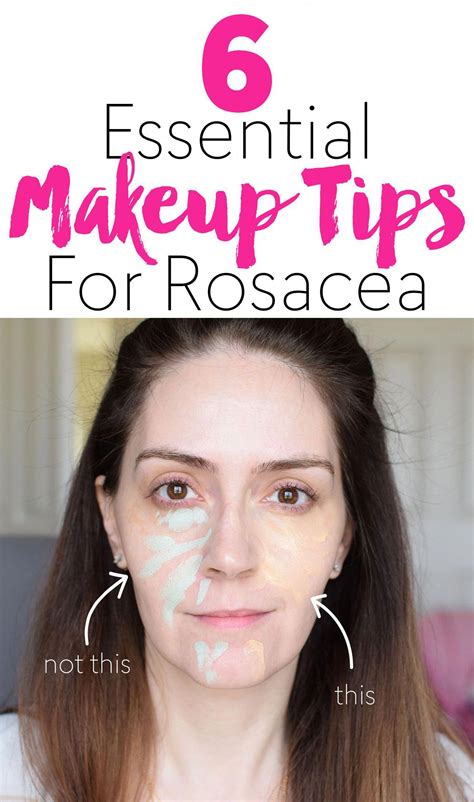 18 Best Makeup For Rosacea Sufferers Uk Ideas