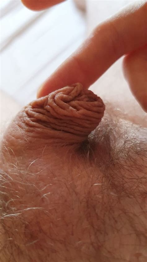 Micro Penis