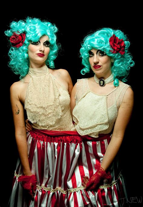 Siamese Twin Girls Telegraph
