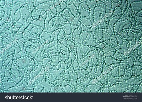 Cyanobacteria Water Stock Photo 757041874 Shutterstock