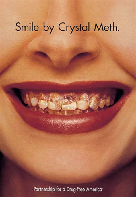 Smile By Crystal Meth Poster 1999 Partnership For A Drug Free