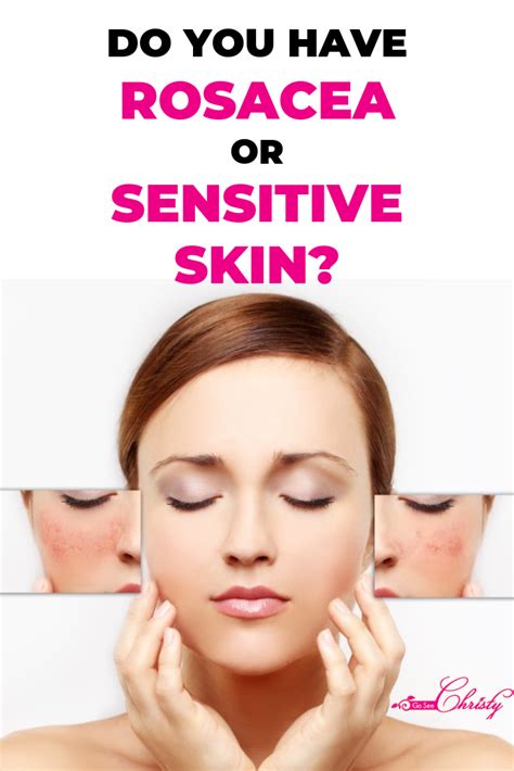 Signs Of Rosacea Vs Sensitive Skin And The 3 Stages Of Rosacea