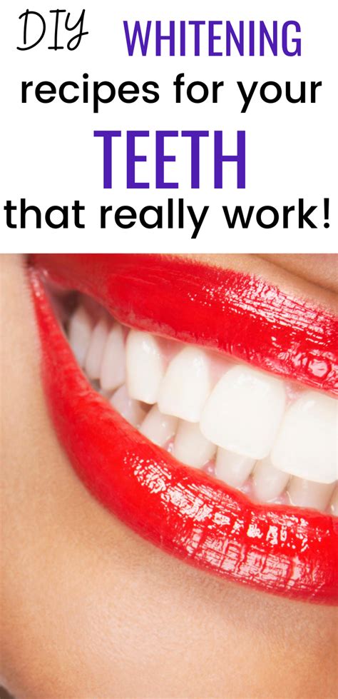 These Simple Teeth Whitening Recipes At Home Are Quick Easy And