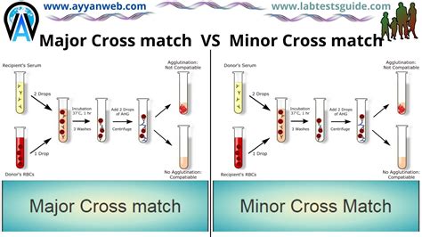 What Is The Difference Between The Major And Minor Crossmatch Lab Tests Guide