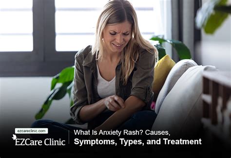 What Is Anxiety Rash Causes Symptoms Types And Treatment